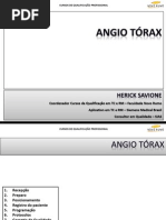 Rm Angio Torax