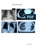 Radiation Fibrosis Case