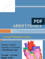 Arrhythmia: Dian Pratiwi Cardiology Department Chasan Boesoerie Hospital