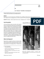 A Patient With Dysphagia: Case Presentation