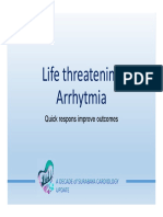 Life Threatening Arrhytmia