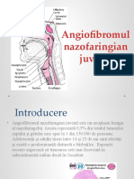 Angiofibromul