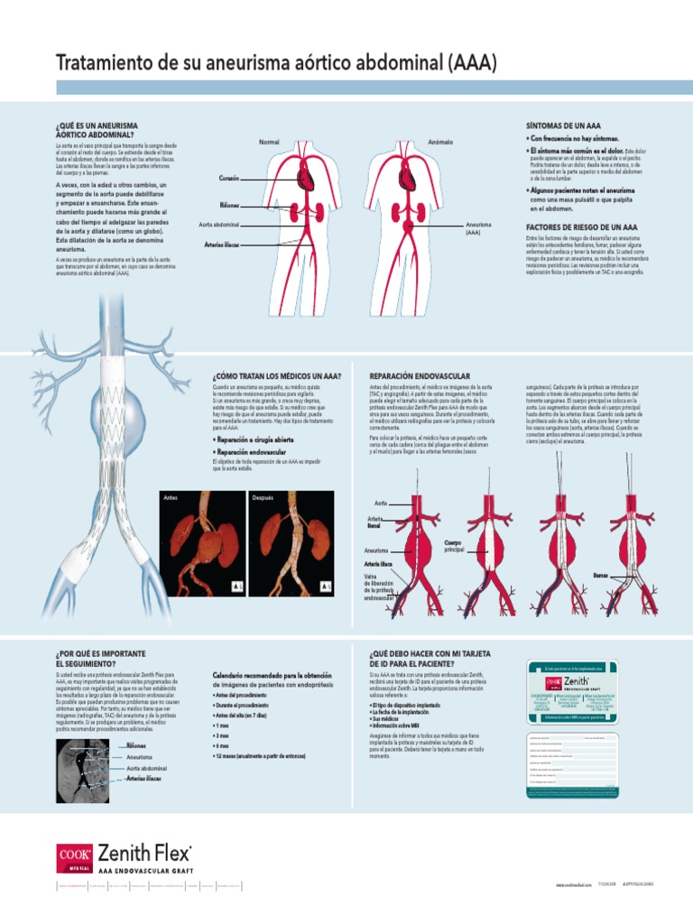 Tratamiento de Aneurisma | PDF | Abdomen | Aorta
