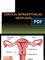 cervical intaepithelial neoplasia