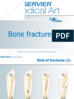 Bone Fractures: A Service Provided To Medicine by A Service Provided To Medicine by