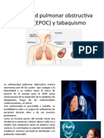 Enfermedad Pulmonar Obstructiva Crónica (EPOC) y Tabaquismo