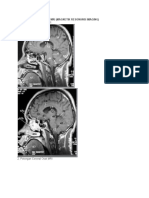 Natomi Otak CT
