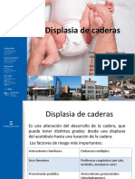 Displasia de Caderas