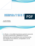 Herniasytipos2 170323044945