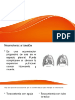 Toracostomia Con Aguja/tubo Toracico