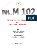 TETRALOGY OF FALLOT