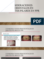 Consideraciones Periodontales en Dientes Pilares en PPR Borrador Dra - Orduz