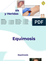 Equimosis y Heridas