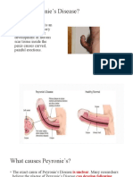 Fourner Disease