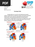 chirurgie TETRALOGIA FALLOT 