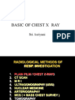 Basic of Chest X Ray: Sri Asriyani