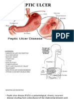 Peptic Ulcer