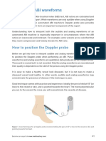 Interpreting ABI Waveforms: How To Position The Doppler Probe