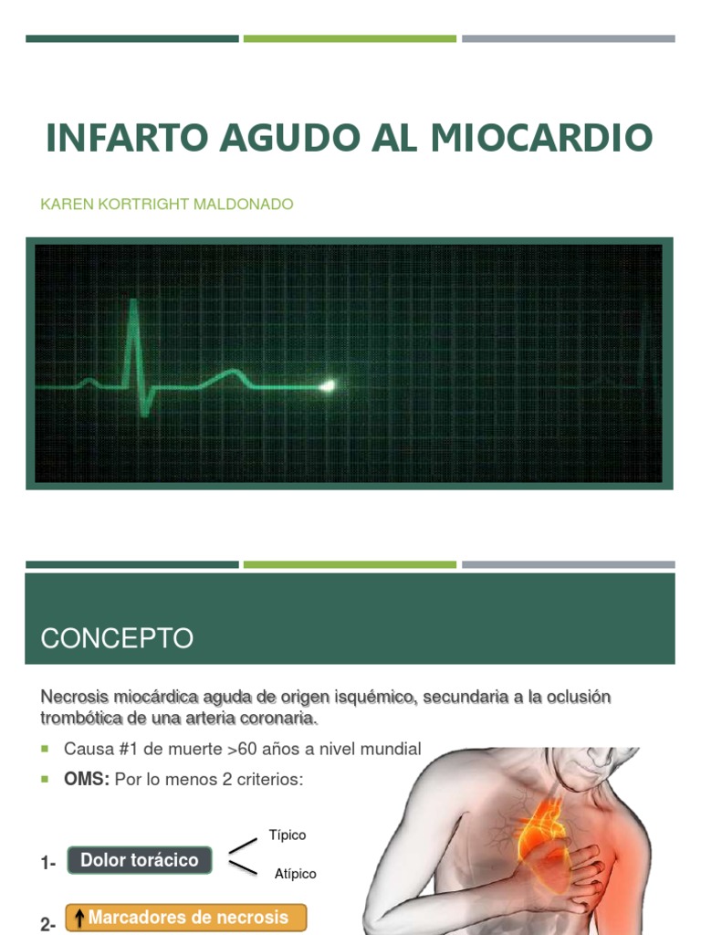 Infarto Agudo al Miocardio: Guía Clínica | PDF | Infarto de miocardio ...