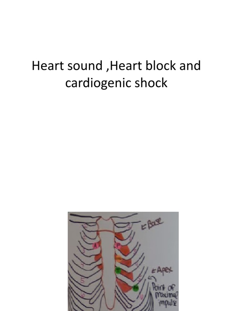 Cardiogenic Shock Nclex PDF Shock (Circulatory) Heart