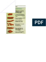 Clasificacion de Heces Fecales