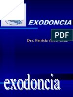 Concepto de Exodoncia