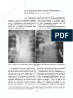 Phlebography in Superior Vena Caval: Obstruction'