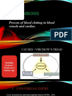 Thrombosis: Process of Blood Clotting in Blood Vessels and Cardiac