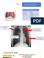 Neumotórax y Atelectasia