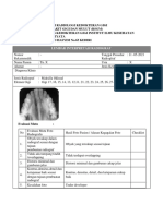 Iqbal Faturahman (40620112) - Radiologi Oklusal