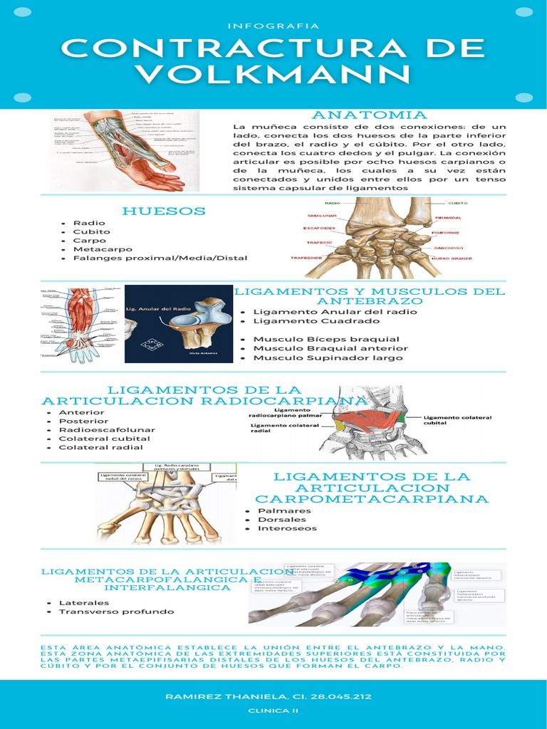 Contractura de Volkmann: Guía Completa | PDF | Mano | Sistema