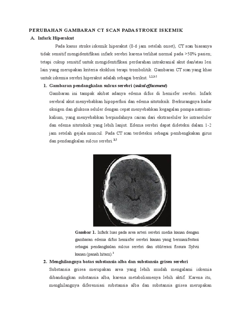 Perubahan Gambaran CT Scan | PDF