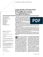Image Quality of Prospectively ECG-Triggered Coronary CT Angiography in Heart Transplant Recipients