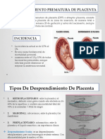 Desprendimiento Prematuro de Placenta