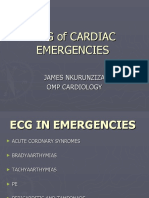 Basics of EKG Interpretation