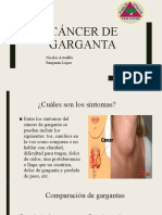 Cáncer de Garganta