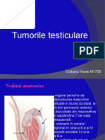 Tumori testiculare