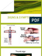 Marfan Syndrome - Hema