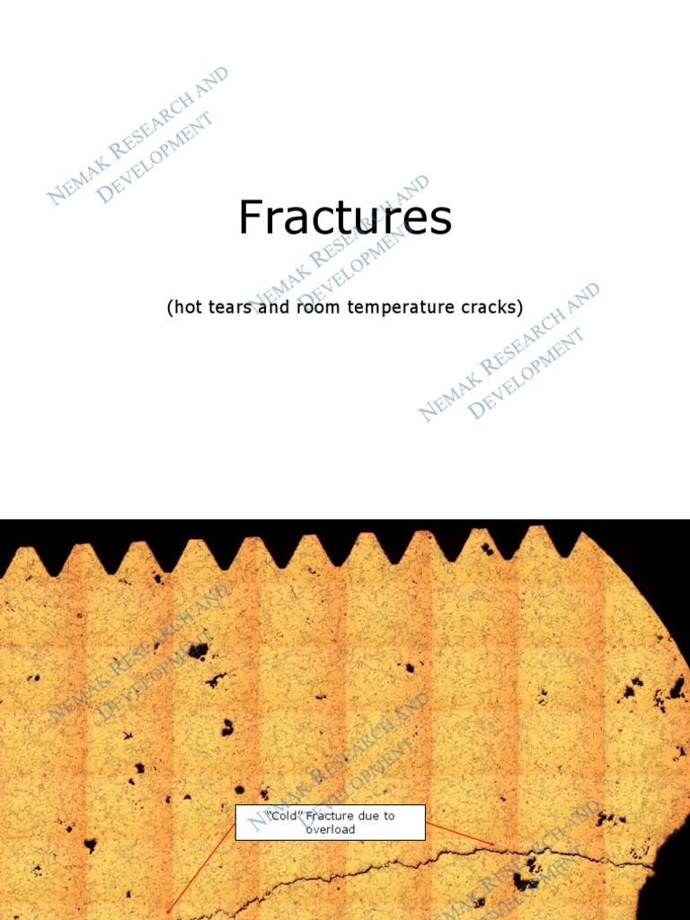 Fractures, Defects & Microstructure Analysis | PDF | Casting ...