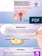 Sindrome de Ovarios Poliquisticos