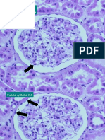 Podocyte Visceral Epithelial Cell