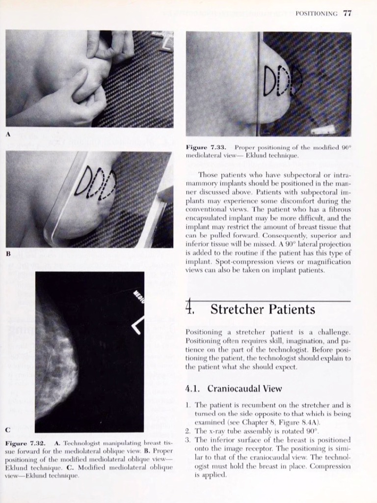 Mammographic Positioning.3 | PDF