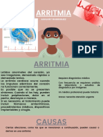 ARRITMIA