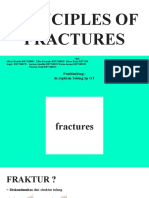 Principle of Fracture