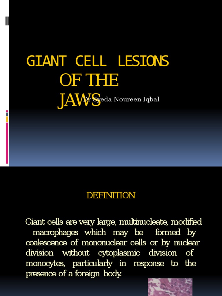 Giant Cell Lesions of The Jaws: DR Syeda Noureen Iqbal | PDF | Monocyte ...