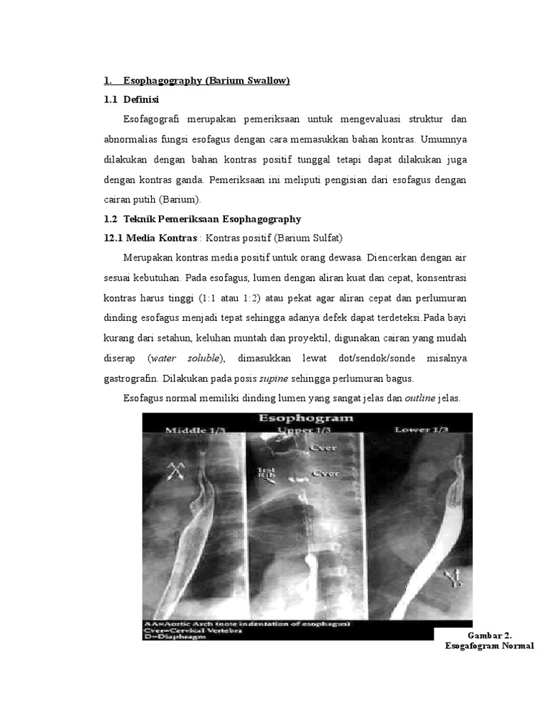 Teknik Esofagografi dengan Barium | PDF | Kesehatan Holistik