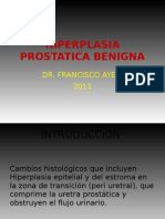 Hiperplasia Prostatica Benigna