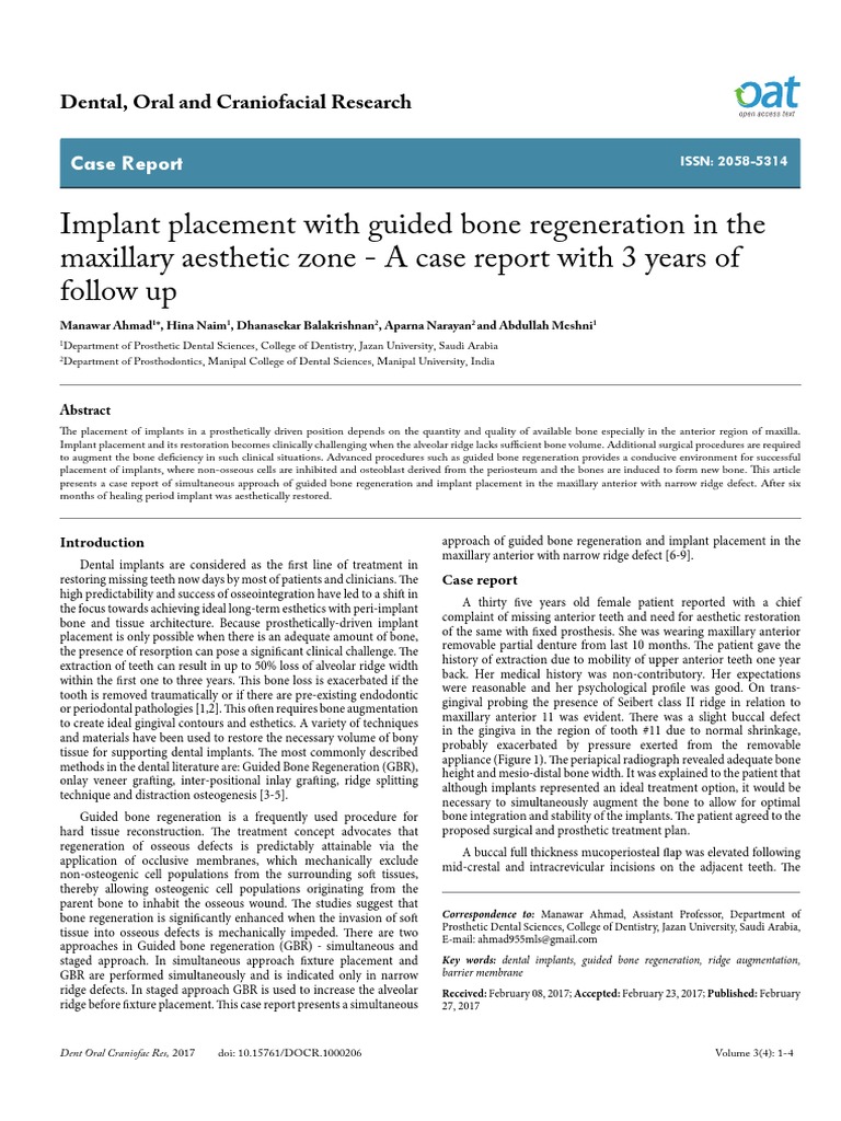 Guided Bone Regeneration | PDF | Dental Implant | Mouth