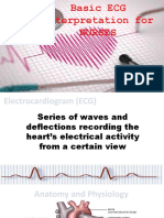 ECG