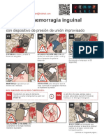 Control de hemorragia inguinal con presión y torniquete improvisado